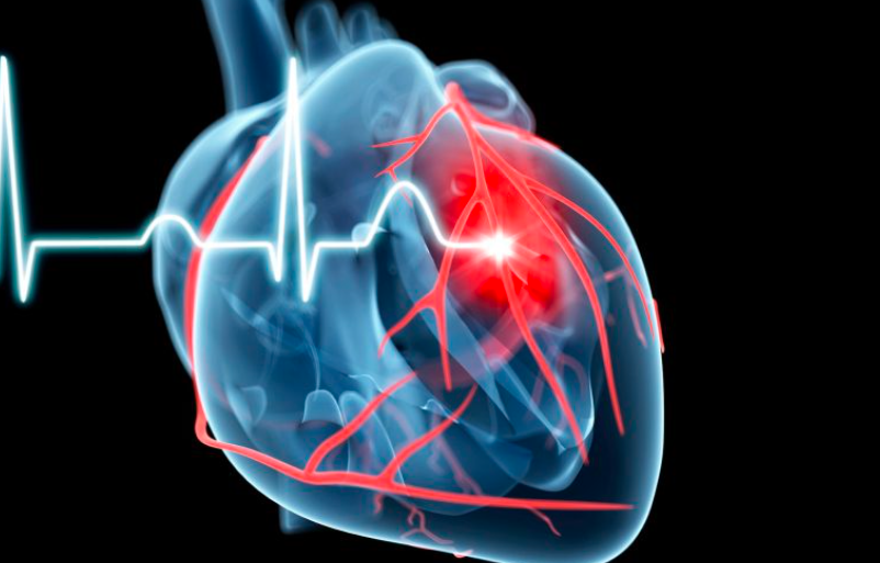 Work Stress Linked to a 97% Increased Risk of Irregular Heart Rhythm